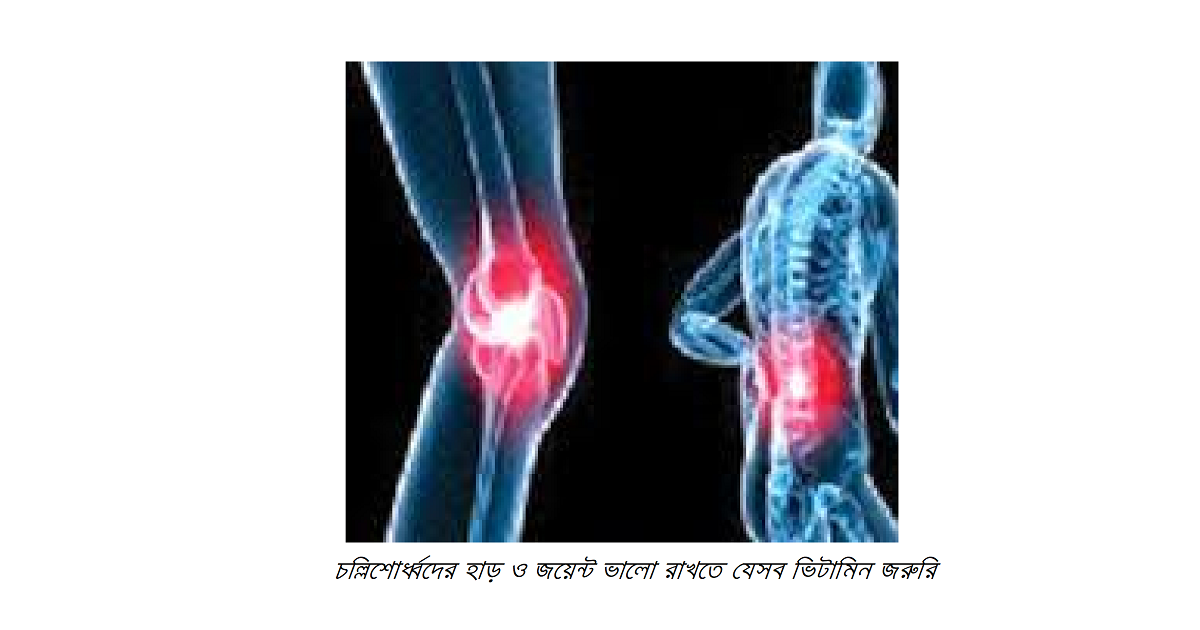 চল্লিশোর্ধ্বদের হাড় ও জয়েন্ট ভালো রাখতে যেসব ভিটামিন জরুরি